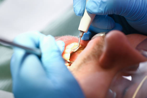 Best Root Canal Emergency Dentist  in Thomasville, GA
